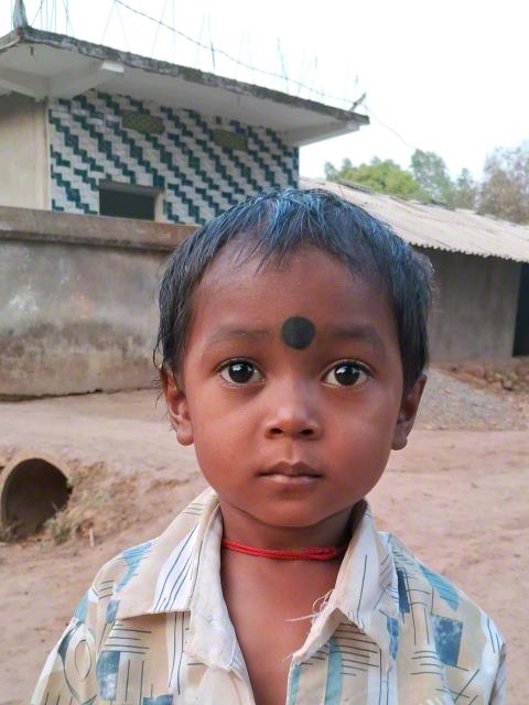 World Vision India